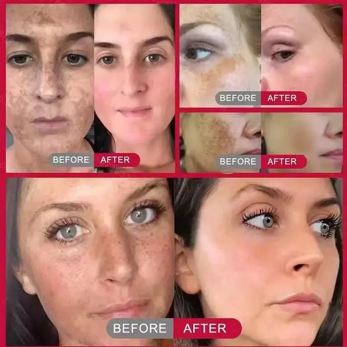 Crème blanchissante pour le visage