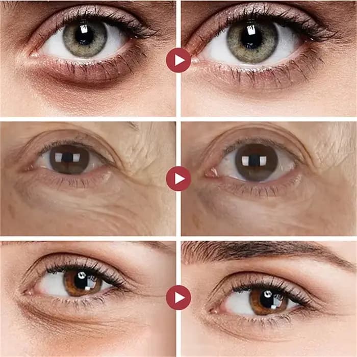 Crème pour les yeux, élimine les cernes