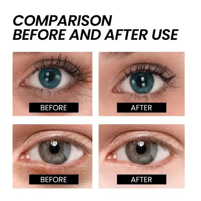 Les sacs pour les yeux crème élimine instantané les cernes resserre