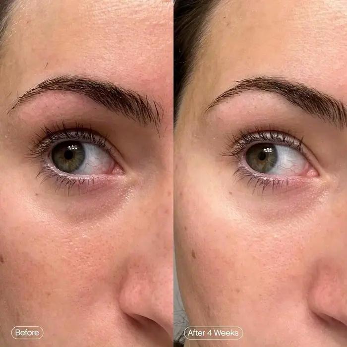 Démoloration et éclaircit le masque facial | activer les patchs