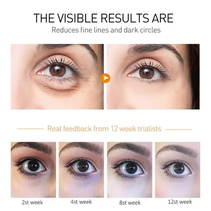 Crème pour les yeux, élimine les cernes