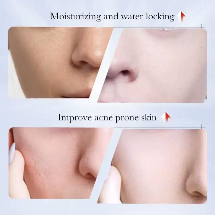 1/2/4 pièces SADOER acide kojique crème pour le visage hydratante taches de rousseur crèmes éclaircissantes