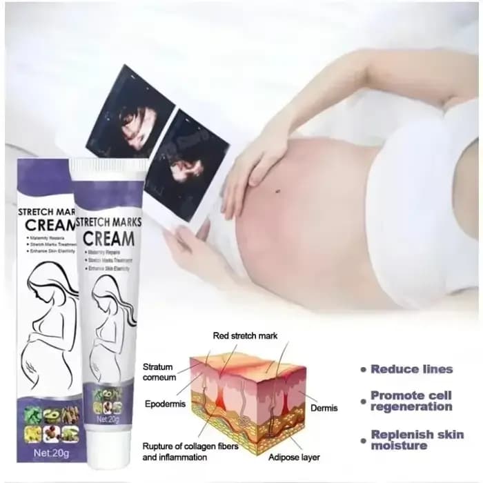 Soins de la peau améliore l'élasticité efficace après la grossesse élimination des vergetures crème de maternité