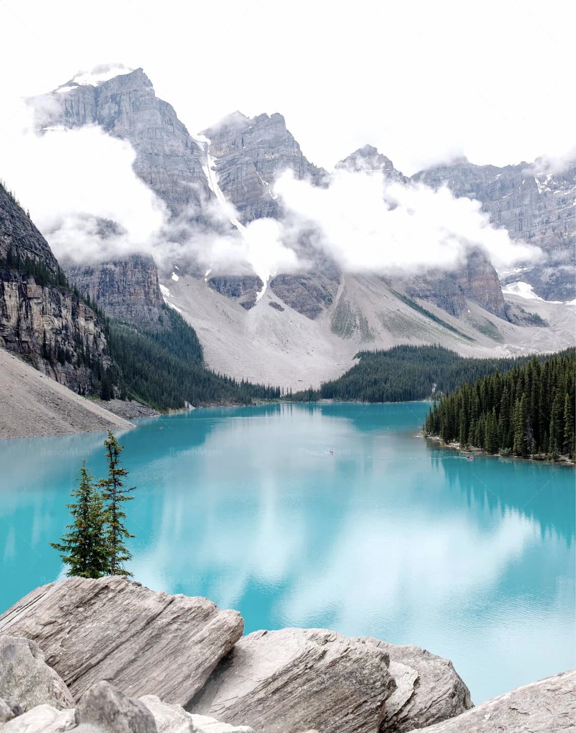 Ensemble de 3 imprimés d'art mural lac louis, imprimés de paysage, Art de montagne naturel du Canada