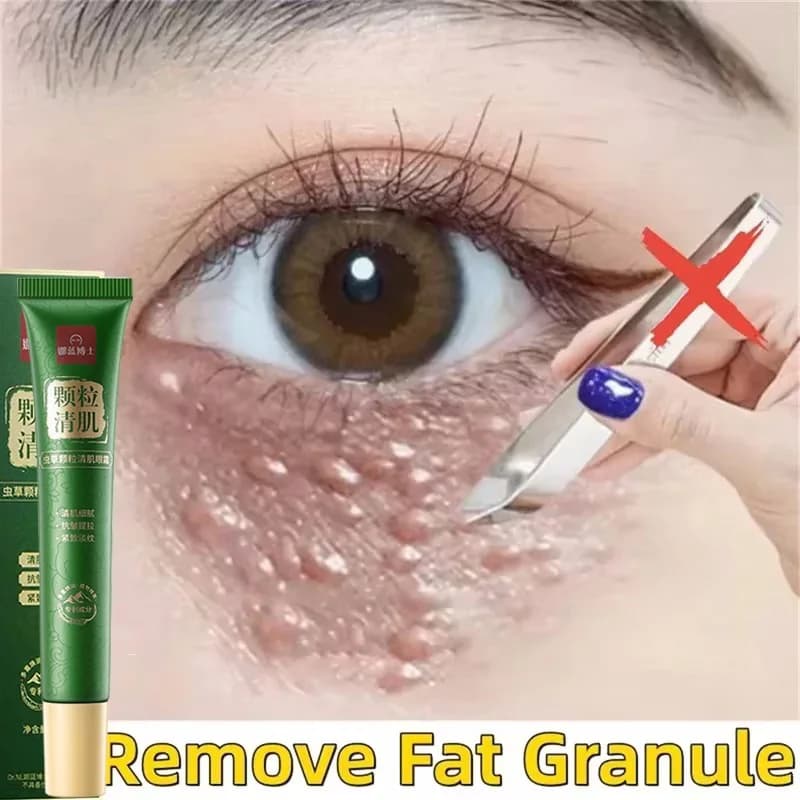 Crème Contour des Yeux Anti-Graisses, Anti-Poches, Anti-Inflammatoire, Réduit les Cernes et les Sacs