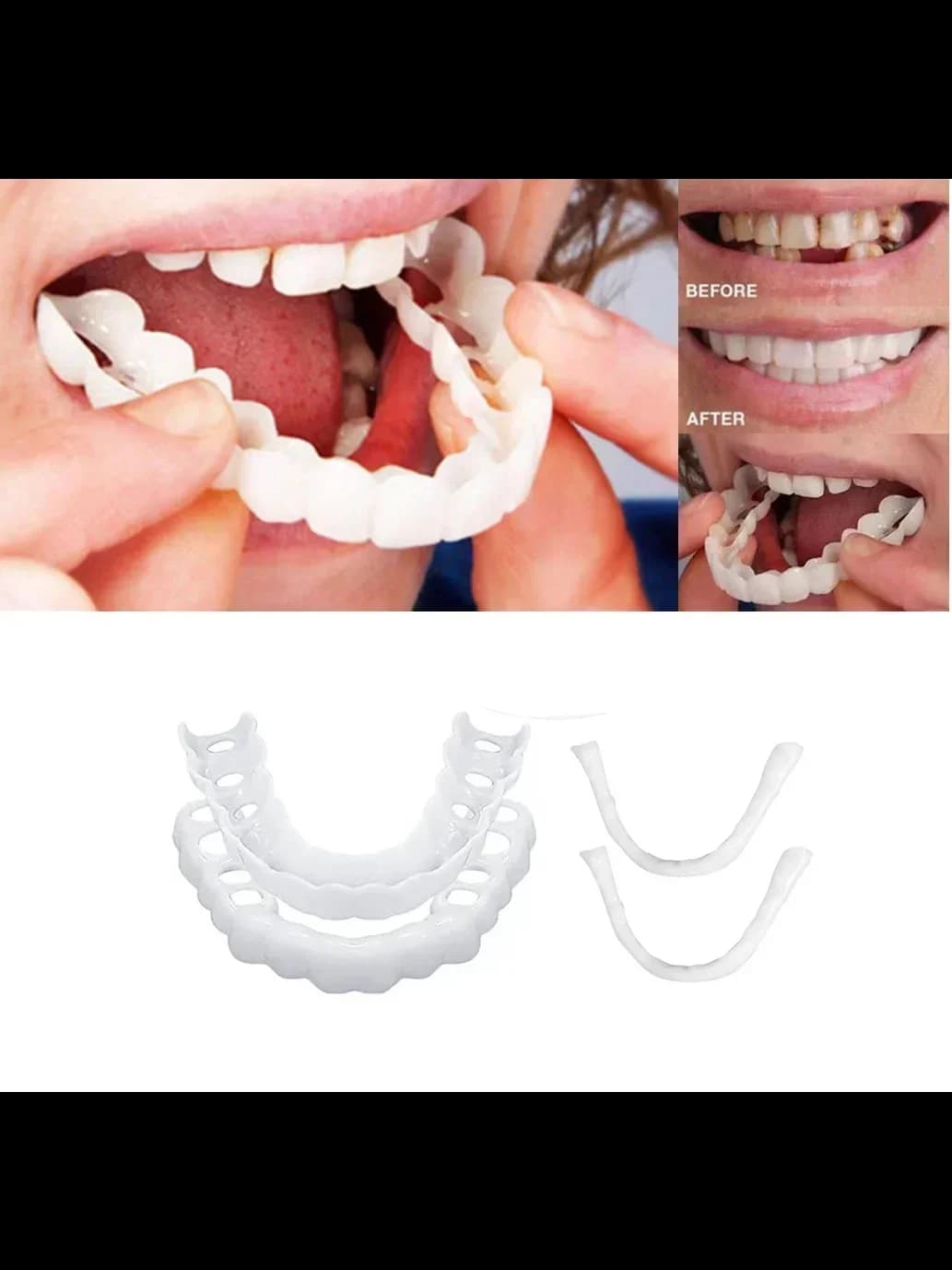 Dernières prothèses dentaires Snap-on Smile pour dents supérieures et inférieures, couvre-dents arti