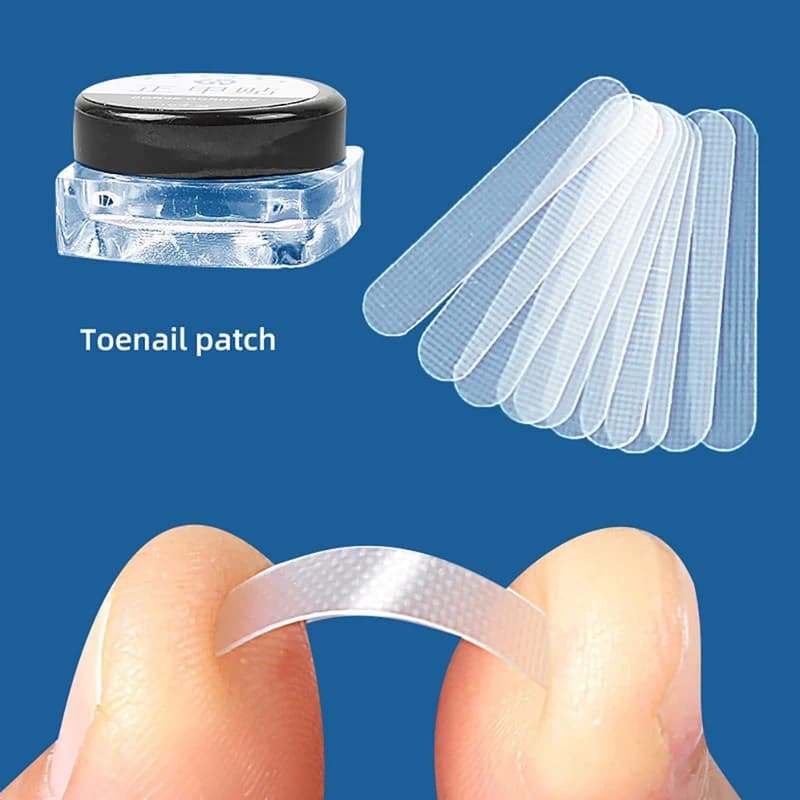 Traitement des ongles incarnés, outil de Correction des ongles incarnés, Patch élastique autocollant