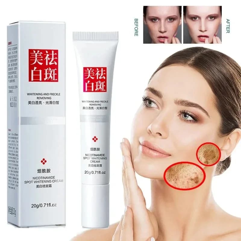 Crème pour le visage, estompe les taches de rousseur, taches foncées, Niacinamide, crème blanchissan