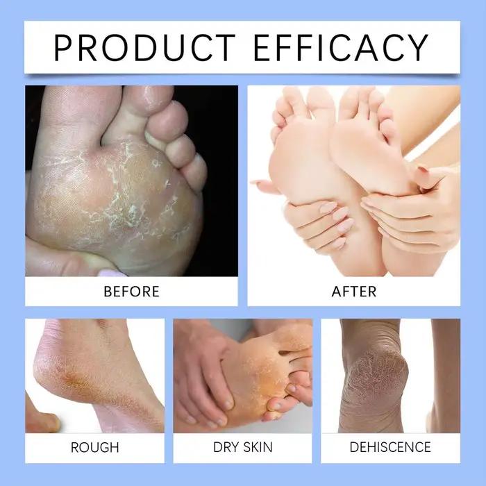 Crème pour les pieds à l'urée