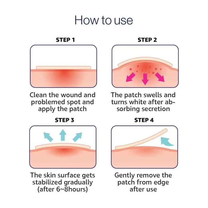 Olive Young Care Plus Spot Cover Spot Patch