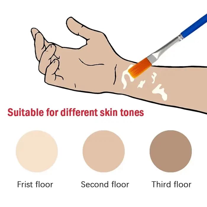 30mlVitiligo Leukoderma couvrant liquide imperméable correcteur crème