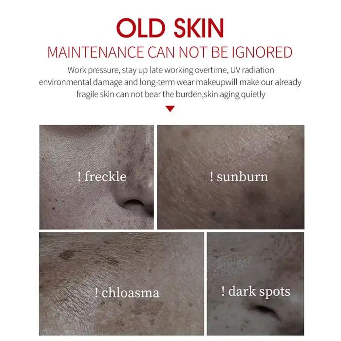 Crème pour le visage blanchissante les taches de rousseur élimine