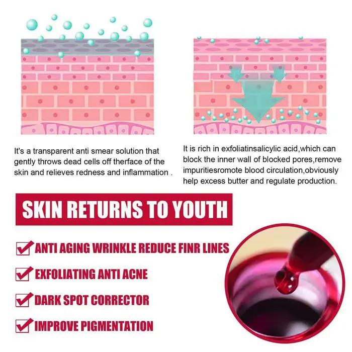 Sérum à l'acide salicylique traitement de l'acné pores lisses blanchissant pour peau grasse produit de soin hydratant face care jaysuing
