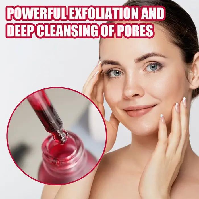 Sérum à l'acide salicylique traitement de l'acné pores lisses blanchissant pour peau grasse produit de soin hydratant face care jaysuing