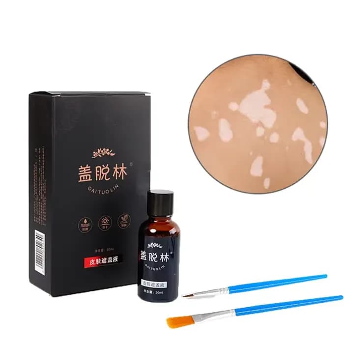 30mlVitiligo Leukoderma couvrant liquide imperméable correcteur crème