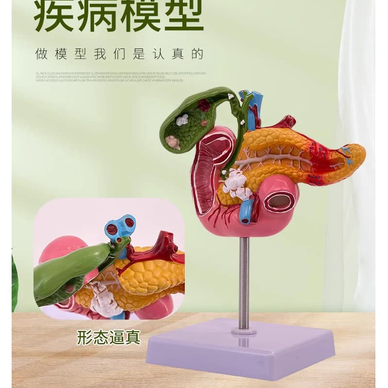 Modèle pathologique médical de pancréas